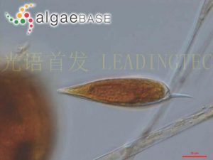 圖19. 纖細原甲藻 (Prorocentrum gracile) ( AlgaeBase Image Reference: 10643）