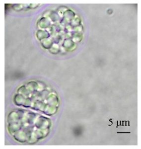 圖12. Aurantiochytrium limacinum（不知道中文叫什么，可以看到細胞里一個個油滴，by Abad &Turon, 2015）